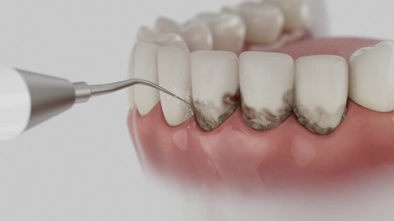 Reliable Root Canal Treatment contractor in Wayne County County, UT by Dentist Open Now